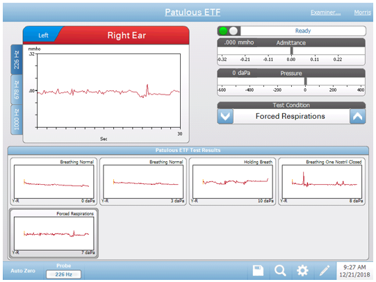 tsp-ate-screen-3